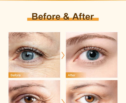 Anti Dark Circle Cream