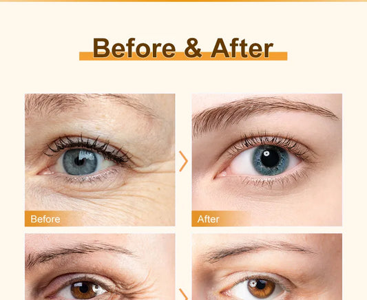 Anti Dark Circle Cream